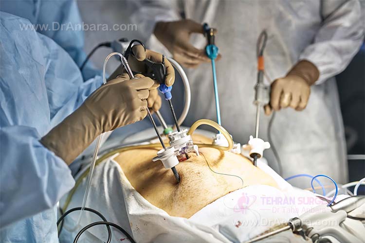 laparoscopic surgery