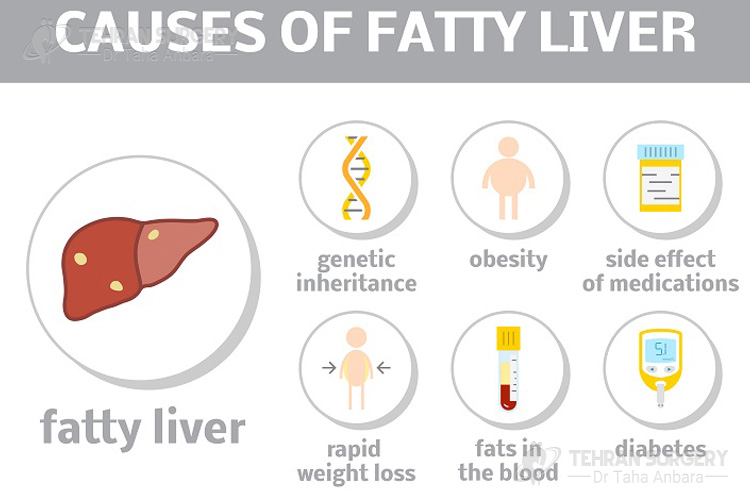 Fatty liver causes