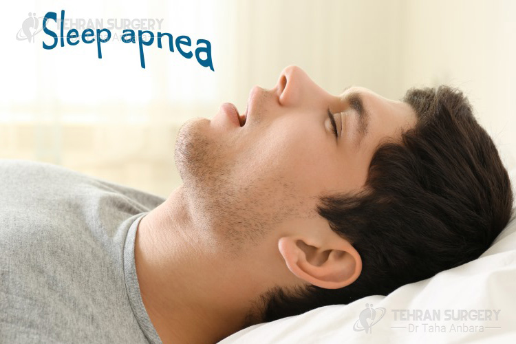 sleep apnea