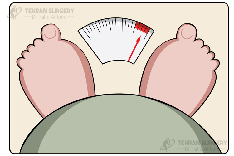 bariatric surgery advantages