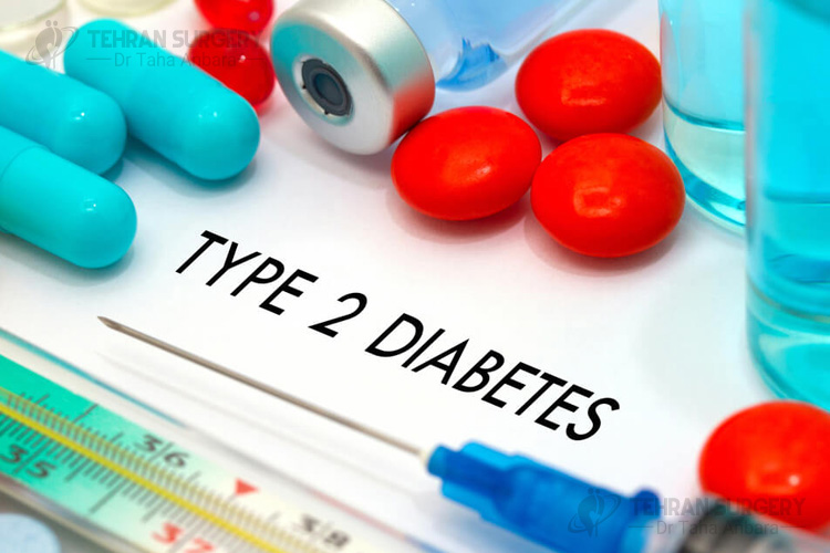 type 2 diabetes